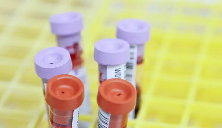 Abnormal Blood Results Abnormal Blood Results